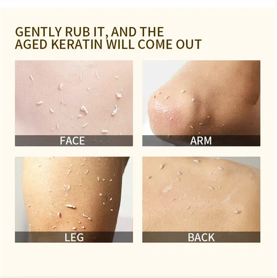 🍊 Tidsbegrenset tilbud: Kjøp 1, få 1 gratis! Appelsin peelinggel – fjerner skånsomt døde hudceller ✨